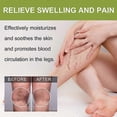 thumbnail image 3 of 1-3pcs Anti-Varicose Cream, Varicose Relief Cream, Anti-Varicose Soothing Cream, Varicose Relief Cream For Legs, 3 of 5