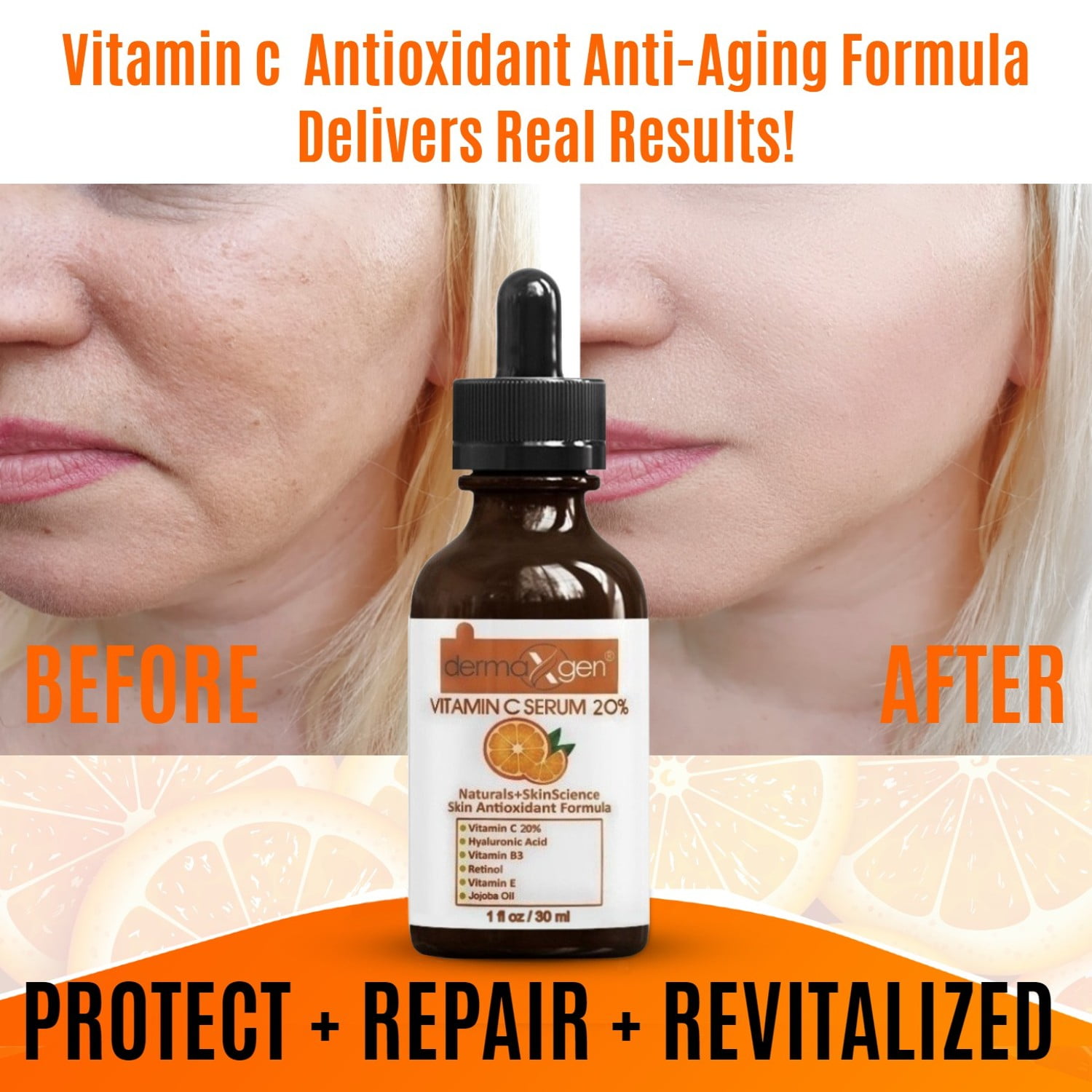 20% Vitamin C Serum (1 Fl Oz) Pure Organic Anti- Wrinkle + Hyaluronic Acid + Retinol + Vitamin E + Vitamin Pure Organic- Boost Skin Collagen Facial Serum For Anti-aging, Fine Line Wrinkles - Walmart.com