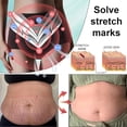 thumbnail image 3 of ADFIRE - Pantalones cortos molderes de turmalina de fibra de titanio, bragas de control de abdomen, encogen el abdomen y las nalgas, moldeando eficazmente, 3 of 3