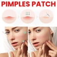 thumbnail image 5 of 200 Counts Star Pimple Patches for Face, Hydrocolloid Star Acne Patches, Cute Star Zit Covers for Face, Colorful Spot Stickers with Tea Tree, Salicylic Acid & Cica Oil, 5 of 9