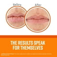 thumbnail image 2 of Bálsamo labial sin perfume O'Keeffe's Lip Repair para labios secos (paquete de 3), 2 of 5