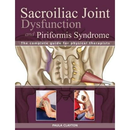 Sacroiliac Joint Dysfunction and Piriformis Syndrome - (Best Cure For Piriformis Syndrome)