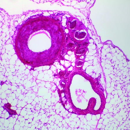 Mammal Artery & Vein C.S. 7 M H&E Microscope Slide price history on PriceWatchPro