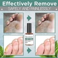 thumbnail image 4 of 3pcs Corn And Calluses Remover Gel Foot Callus Removal Treatment Hard Skin Pedicure, 4 of 5