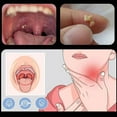 thumbnail image 6 of Soug Ear Wax Tonsil Stone Remover ,personal care, Mouth Cleaning Care Tools New, 6 of 8