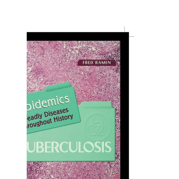 Tuberculosis (Paperback)