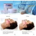 thumbnail image 2 of Orthèse Anti-Ronflement, Embout Dentaire Anti-Bruxisme, Solution Anti-Ronflement Oral, Ajustable Réutilisable Portable, 2 of 4
