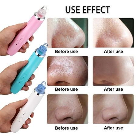 Best Electric Blackhead Remover Pore Cleaner Vacuum Suction Facial Blackhead Removal Nose Pore Cleanser Skin Care Cleansing