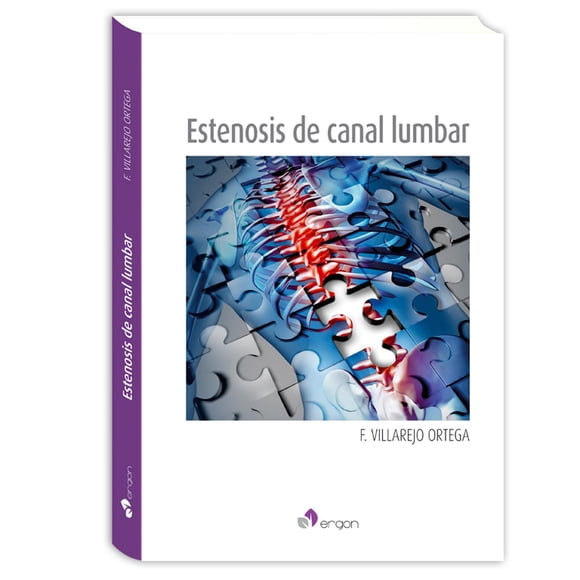 Estenosis de canal lumbar
