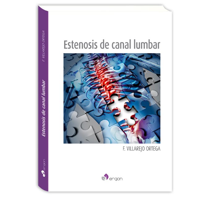 Estenosis de canal lumbar