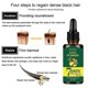thumbnail image 2 of Paquete de 3 aceite germinal de jengibre, suero para el crecimiento del cabello, aceite esencial, tratamiento para la pérdida de cabello, cuidado del cabello Sincero Hogar, 2 of 2