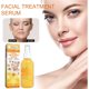 thumbnail image 1 of Hot6sl Ofertas Del Día Spray Anti-Argugas y Retinol, 30 Ml, 1 of 7