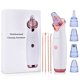 thumbnail image 4 of 【Incluye video】Limpieza facial profunda con aspirador eléctrico de puntos negros, 3 niveles de succión, 5 cabezales intercambiables y kit de extracción de acné en tono rosa dorado. ¡Ideal para pieles, 4 of 6