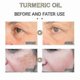 thumbnail image 5 of 30ml Turmeric Oil Pure Natural Pleasant Moisturizing Anti-aging Serum Lig, 5 of 5