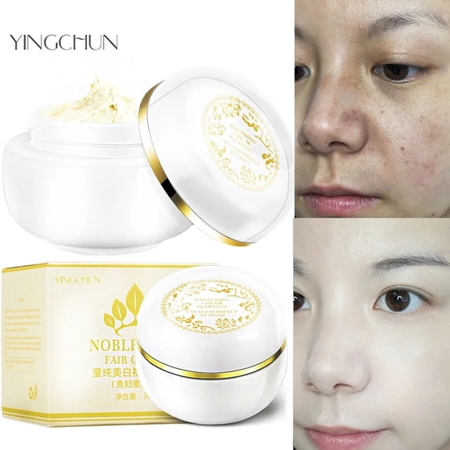Crema Facial con ácido azelaico 20%, elimina manchas oscuras, acné, líneas finas, blanquea la piel, crema hidratante para el cuidado de la piel"Blanco" Fivean LED