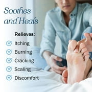 Tender Gentle Miconazole Antifungal Cream for Skin - 4 oz - Miconazole Nitrate for Jock Itch, Athlete's Foot, Itching, and Ringworm
