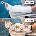 thumbnail image 7 of COEQINE Highland Cow Leg Cast Covers Flower Broken Leg Shower Cast Cover Outdoor Leg Protection Cover Elastic Cast Socks Cover Cast Decorative Leg Cast Cover for Kids Girls Size M, 7 of 7