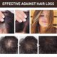 thumbnail image 2 of Scalp Hair Thickness Essence Hair Care Strengthening Hair Repair Repairing Roots Thick Hair Moistur, 2 of 4