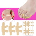 thumbnail image 3 of Pegatinas correctoras de uñas encarnadas, herramientas de pedicura correctoras de recuperación de paroniquia, 3 of 8