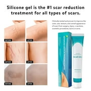 Aroamas Scar Advanced Scar Gel - Medical-Grade Silicone Scar Gel for Surgical Scars, for Face, Scar gel with silicone for Keloids, C-Section, Cosmetic Procedures, Burns, Injuries - 45g