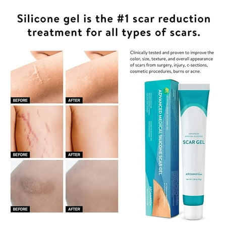 Aroamas Scar Advanced Scar Gel - Medical-Grade Silicone Scar Gel for Surgical Scars, for Face, Scar gel with silicone for Keloids, C-Section, Cosmetic Procedures, Burns, Injuries - 45g