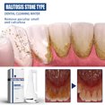 thumbnail image 1 of 3pcs Calculus Remover, Calculus Removal, Teeth Whitening, Eliminating Bad Breath,Mist Spray, 1 of 5