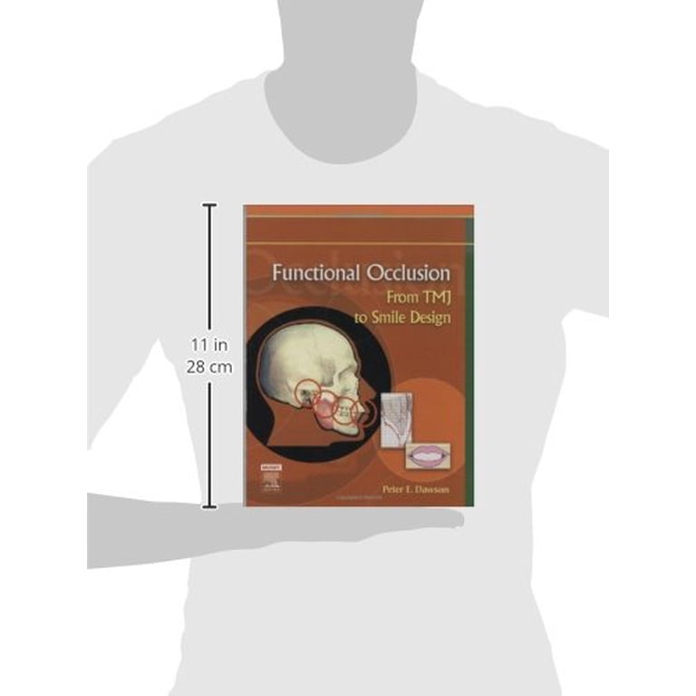 Pre-Owned Functional Occlusion: From Tmj to Smile Design 