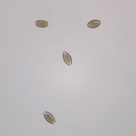 Trichuris Trichiura Eggs Slide, W.M.