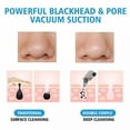 thumbnail image 3 of XIRQI Blackhead Remover Vacuum - Strong Suction Rechargeable Lightweight Pore Cleanser Acne Comedone Zit Pimple Extractor Sucker Tool for Women Men, White, 3 of 7