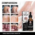 thumbnail image 3 of Nail Repair Liquid Thickening And Bright Nails, 3 of 5