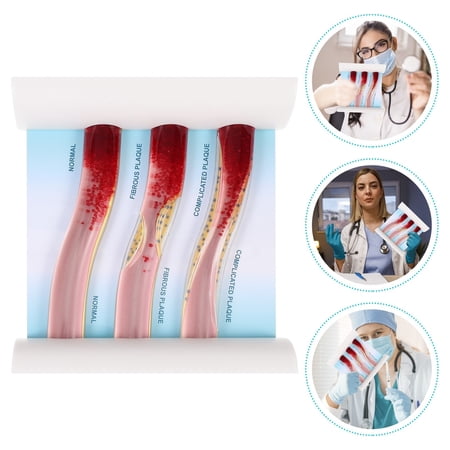 Huaq Medical teaching vascular model dynamic blood lipid vascular comparison medical model