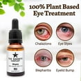 Chalazion Remover, Stye Eye Treatment and Blepharitis Treatment Made