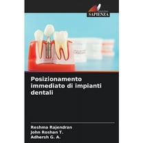 Posizionamento immediato di impianti dentali, (Paperback)