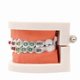 thumbnail image 3 of 1pc Dental Orthodontic Typodont With Ortho Metal Ceramic Bracket Arch Wire Orthodontic Toothed Denture, 3 of 4