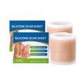 thumbnail image 4 of Silicone Scar Tape Breathable Silicone Scar Plaster For Soft Skin Soft Tape For Skin For Cesarean *5PCS, 4 of 8