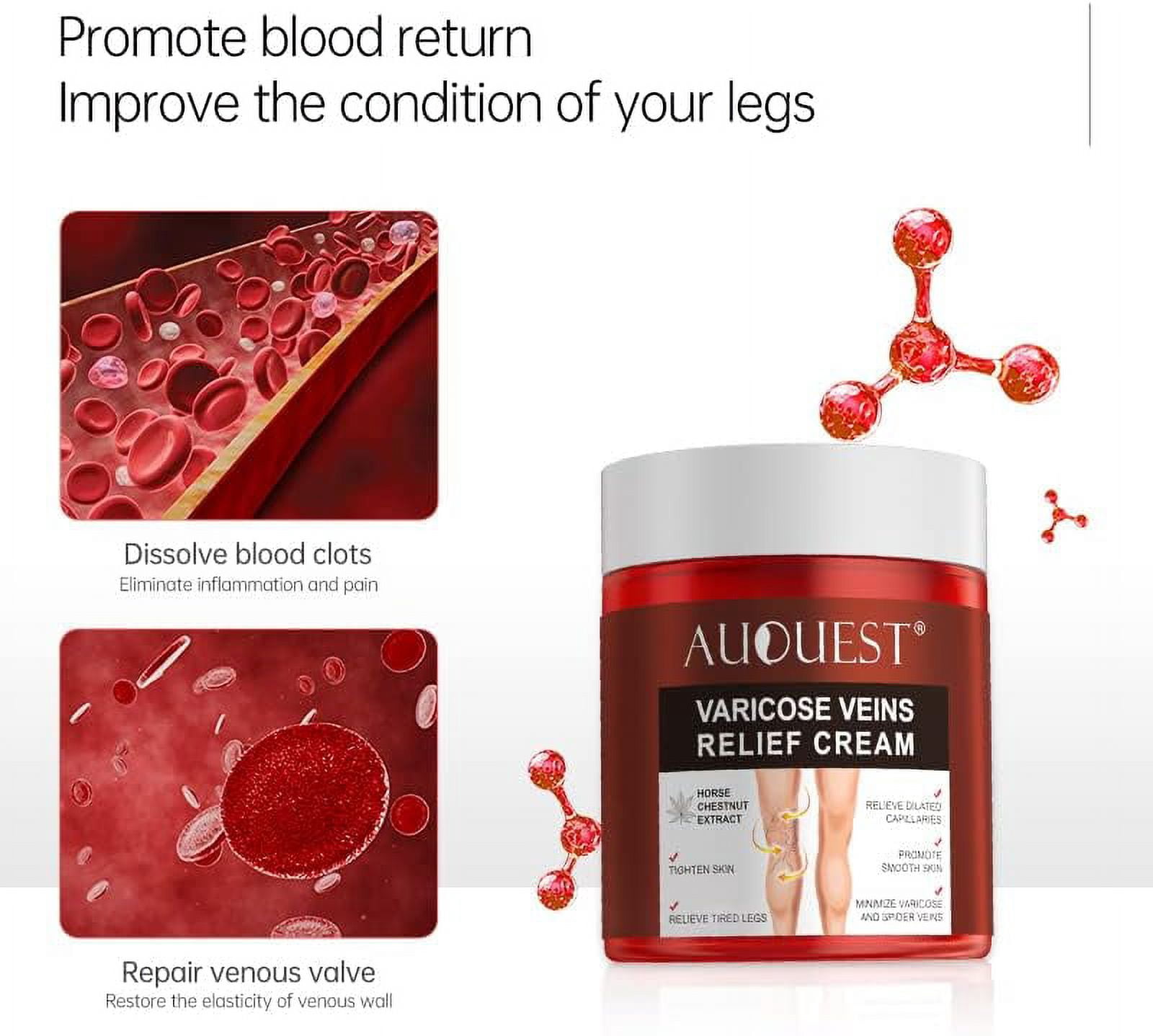 AUQUEST- Varicose Veins Relief Cream Vasculitis Phlebitis Spider Pain Relief Ointment Medical Plaster Body Care- 80g