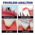 thumbnail image 5 of Toothache Spray Gum Swelling Toothache Toothache Water Licorice Tooth Decay Worm Tooth Fire Caries, 5 of 5