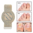 thumbnail image 5 of Waterproof Toenail Fungus Patch - Repair & Correct Ingrown Nails (1/2/3/4/5Pcs) for Discolored or Damaged Nails, 5 of 5