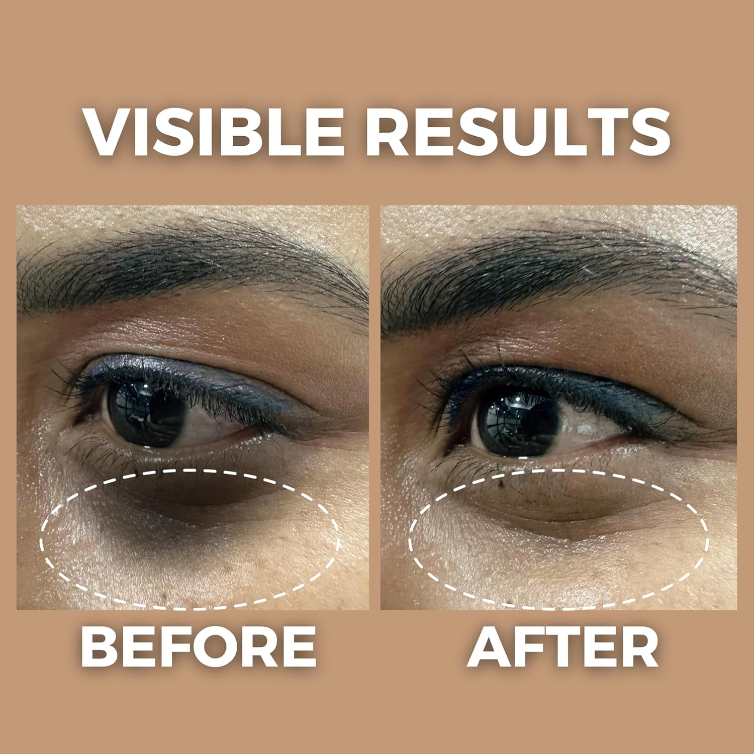 The Tribe Concepts Under Eye Brightening Oil for Dark Circles Removal, Reduces Puffiness Fine Lines, Wrinkles, Aging, Eye Pigmentation with Star Anise, Amla, Natural for Men Women - 8 ml Pack of 1