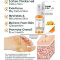 thumbnail image 4 of Foot Callus Removal Spray, Foot Heel Callus Remover Spray, Foot Peel Spray, 4 of 5