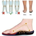 thumbnail image 4 of Espadrilles Orthopédiques pour Femmes, Espadrilles à Plateforme Extensibles en Maille, Mode Décontractée Confortable pour la Marche, 4 of 5