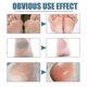 thumbnail image 3 of Chapped Foot Moisturizing Cream Moisturizing, Softening and Anti-Drying Heel Foot C, 3 of 5