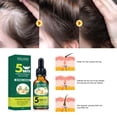 thumbnail image 3 of Fiudx Ofertas relámpago del día Acetato de jengibre, Suero de jengibre, caída del cabello, Adelgazamiento del cabello Promueve, crecimiento del cabello para hombres Adecuado y mujeres 30 ml, 3 of 6