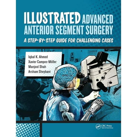 Illustrated Advanced Anterior Segment Surgery: A Step-By-Step Guide for Challenging Cases, (Hardcover)