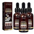 thumbnail image 1 of Jaysuing Coconut Hair Oil Moisturizes And Nutritivates Thick Hair Strengthens Thick Hair Massage Scalp Oil Hair Loss Treatments, 1 of 3