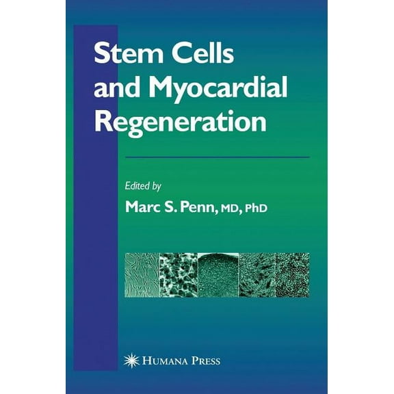 Contemporary Cardiology Stem Cells and Myocardial Regeneration, (Hardcover)