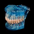 thumbnail image 5 of Dents d'Étude Dentaire Modèle Transparent Maladie Pathologique chez l'Adulte Dentisterie Dentaire, 5 of 5