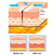 thumbnail image 5 of 2 Pack Skin Closure Device Elastic Self Adhesive Tape Laceration Closure Bandages for Emergency Wound Care, 5 of 5