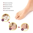 thumbnail image 4 of Parche Adhesivo Para Uñas Encarnadas, 50 Uds., Corrector De Parche Para Uñas De Los Pies, Herramientas De Pedicura, Parche Corrector De Uñas Encarnadas Para Hombres Y Mujeres Yuarrent CE006357-00, 4 of 6