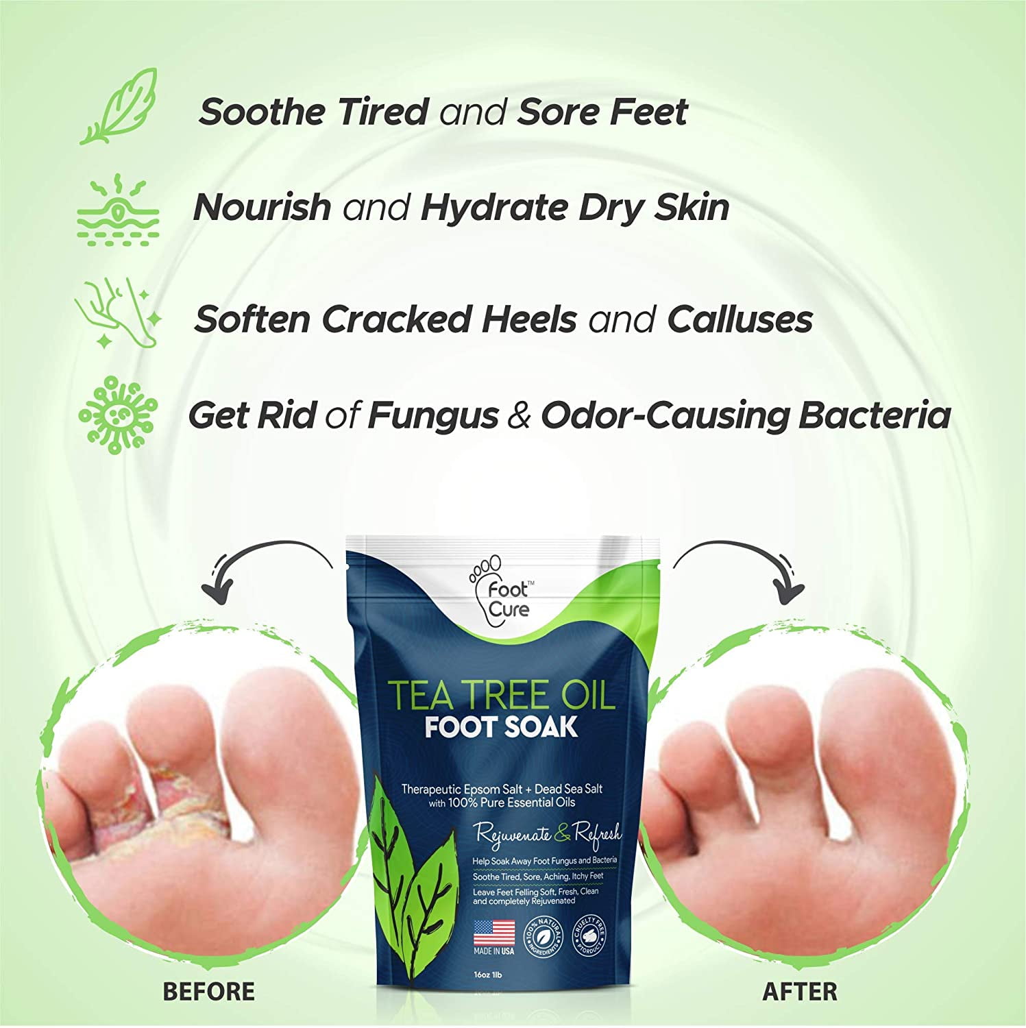 Tea Tree Foot Soak & Callus Remover Gel Kit - Moisturize, Heal, and Re –  Foot Cure